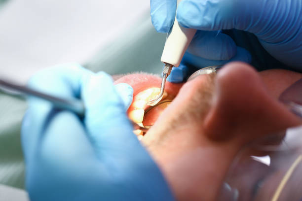 Best Root Canal Emergency Dentist  in Tennille, GA
