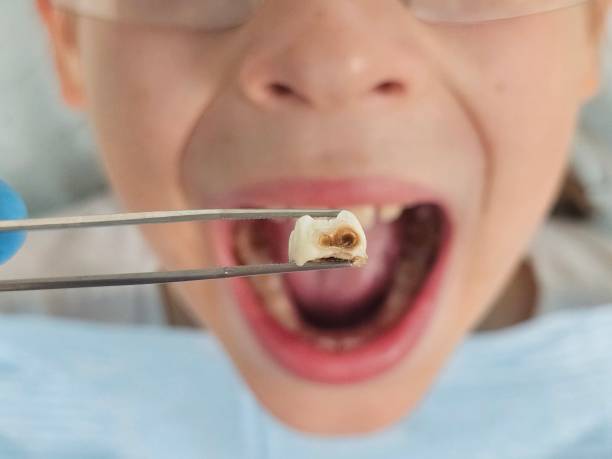 Best Cracked Tooth Emergency Dentist  in Tennille, GA