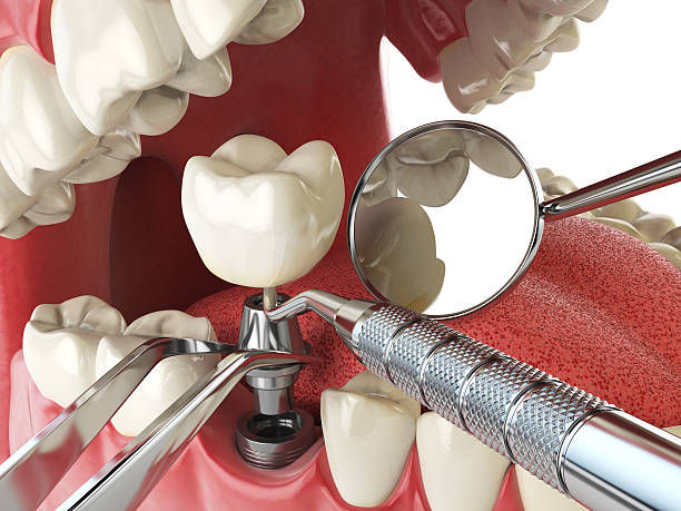 Best Urgent Tooth Repair  in Tennille, GA